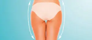 actie endermologie