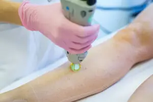 laserontharing actie