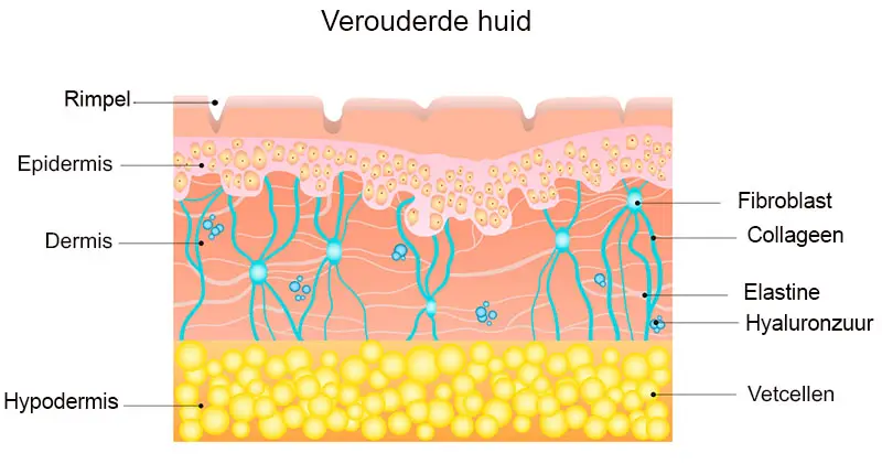 anti-aging verouderde huid