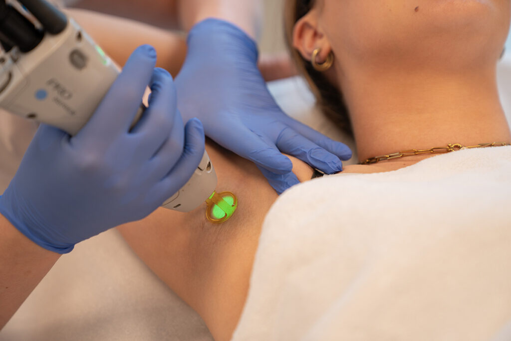 laserontharing van oksels en bikinilijn